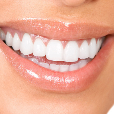 Healthy woman teeth and smile. Close up.